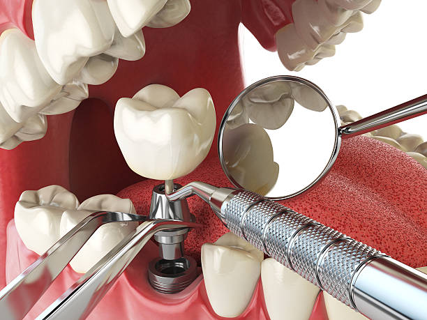 Best Broken or Cracked Tooth Emergency Dentist in Jasper, FL